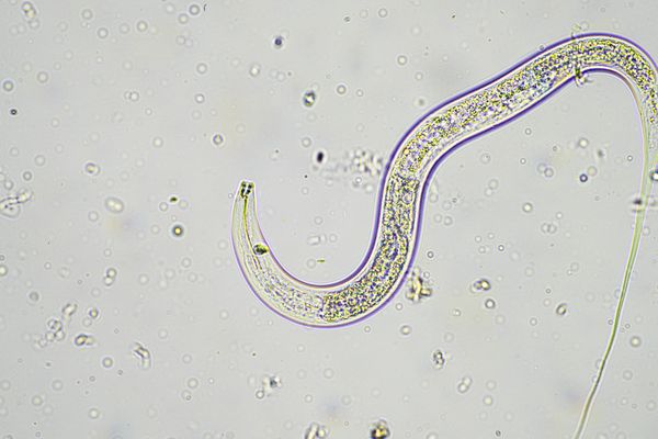 Mikroskopische Aufnahme eines Fadenwurms